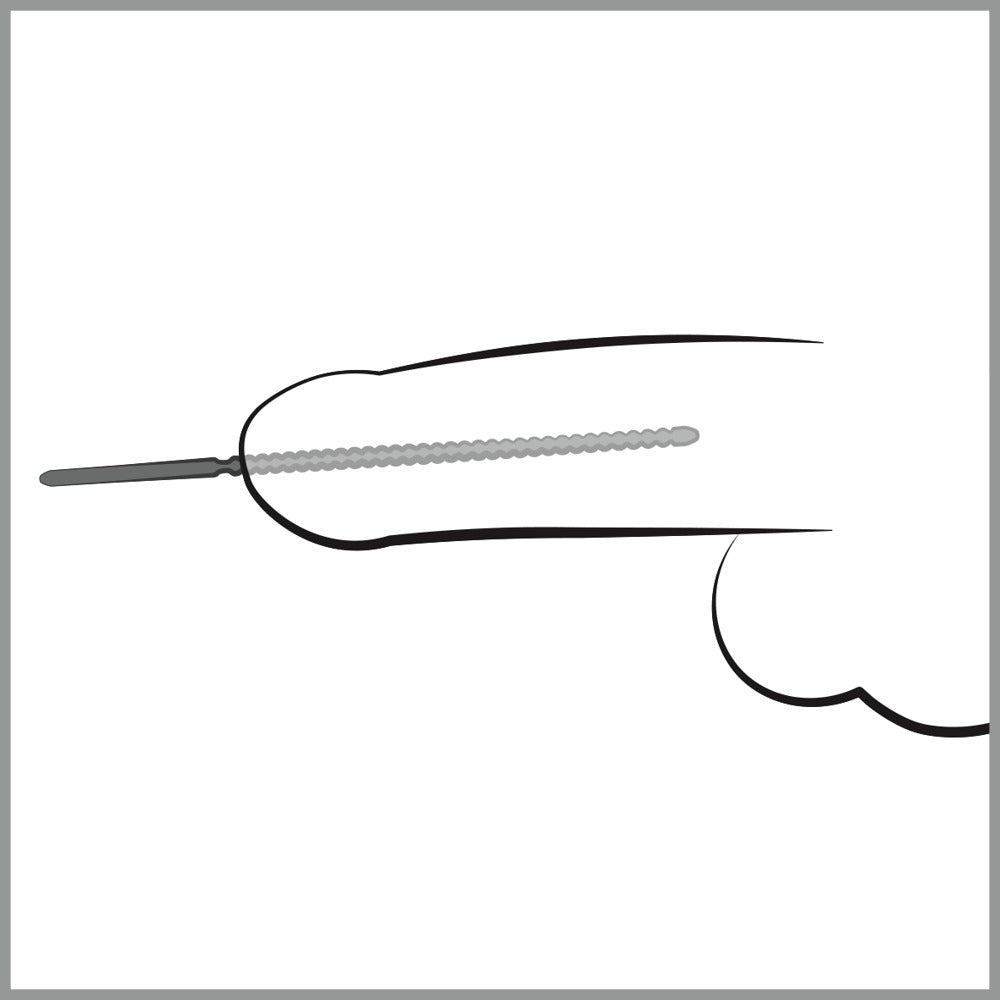 05078650000-4-Dip Stick Ripped Ø 6 mm-4