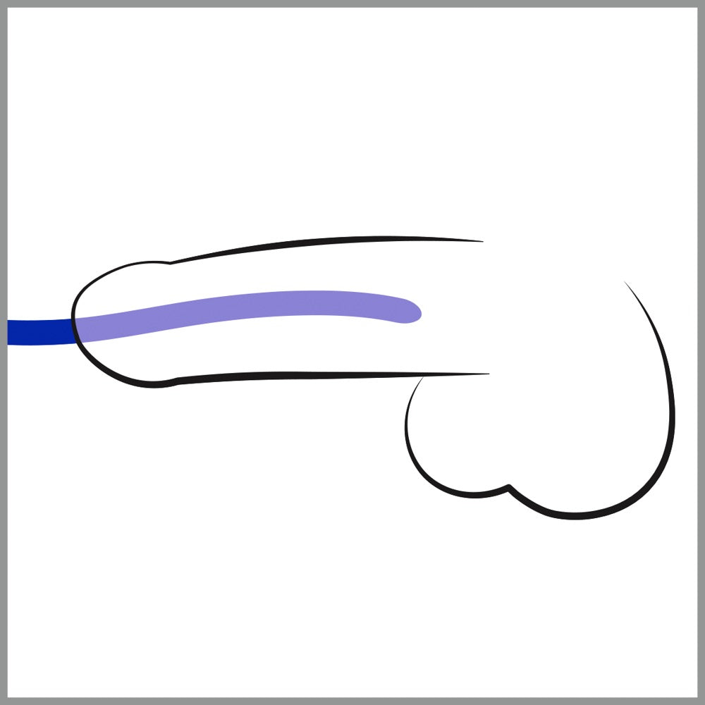 05221390000-3-Silikon Dilator 3er Set-3